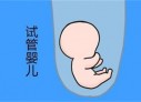 培养绍兴捐卵宝宝艺术细胞的小技巧